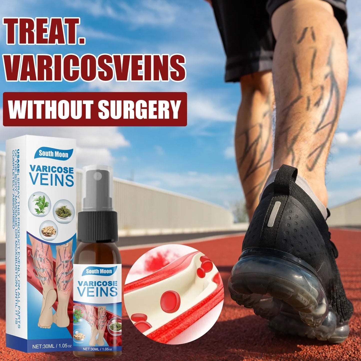 Varicose Vein Spray Vasculitis Phlebitis Relief Cream Spider Legs Treatment