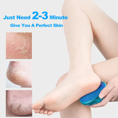 Foot File Hard Dead Skin Callus Remover